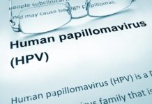 Ce Sunt Verucile Genitale?