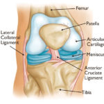 Leziunile genunchilor și tratamentul acestora