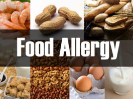 Alergiile Alimentare